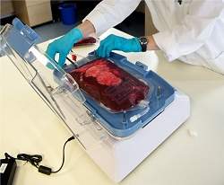 Equipamento recicla sangue do paciente para evitar transfuso