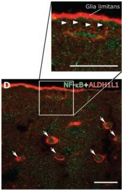 Como a enxaqueca sai dos neurnios e chega aos nervos