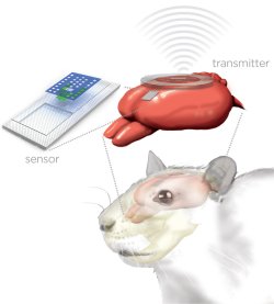 Sensores monitoram o crebro e depois derretem