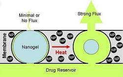 Seringa implantável libera medicamentos sem dor