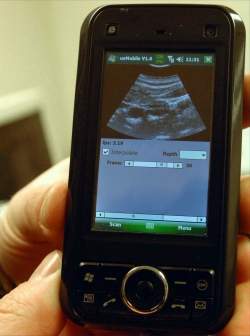 Exames de ultrassom podem ser feitos  distncia com um smartphone