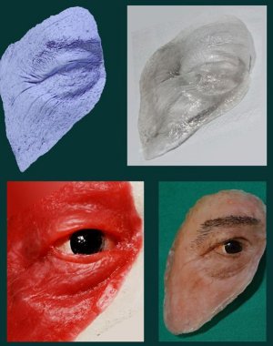 Prótese de baixo custo para implante facial é desenvolvida no Brasil