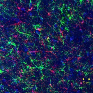 Parkinson pode ir do intestino ao cérebro pelo nervo vago