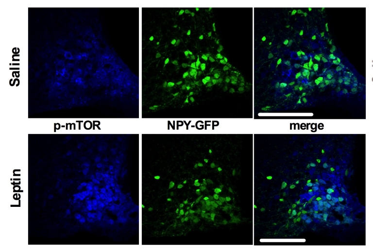 Neurnios impedem queima de gordura quando fazemos dieta