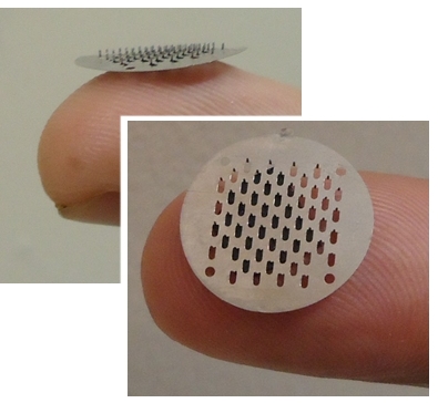 Microagulhas aumentam eficcia de anestesia odontolgica e diminuem dor