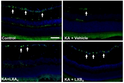 Substncia natural pode interromper glaucoma