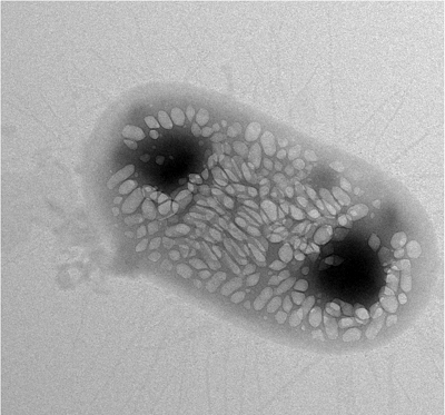 Bactria que reflete sinais de sonar funciona como submarino no corpo humano