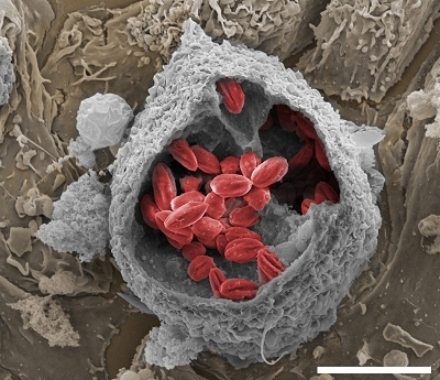 Nanotecnologia viabiliza novo medicamento contra leishmaniose