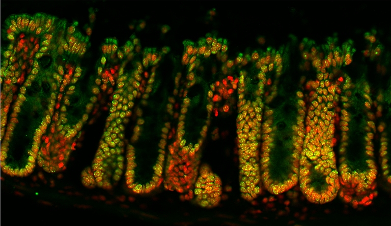 Bactrias benficas do intestino alteram nossos genes