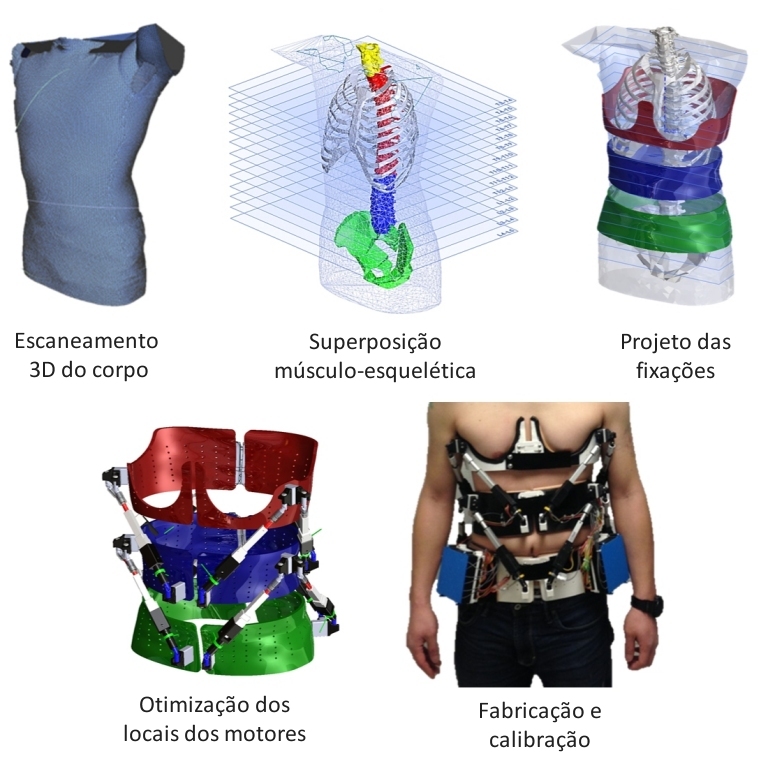 Exoesqueleto robtico muda tratamento de deformidades da coluna