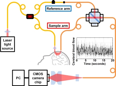 Nova técnica mede atividade cerebral com laser
