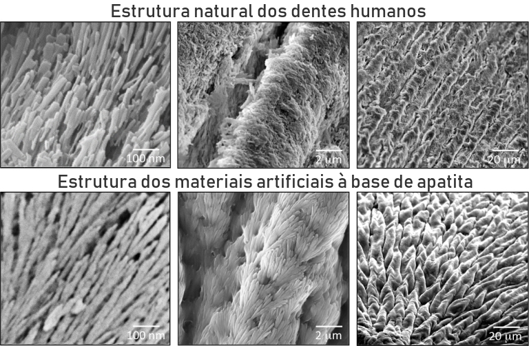 Criado material que pode regenerar esmalte dos dentes