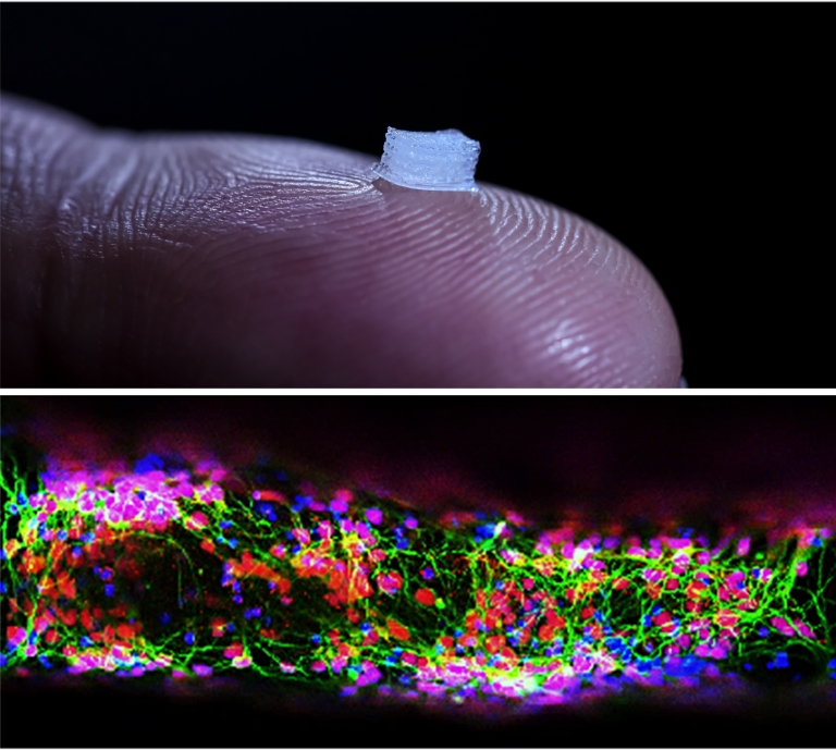 Dispositivo com cÃ©lulas vivas impressas em 3D para recuperar lesÃµes na medula espinhal
