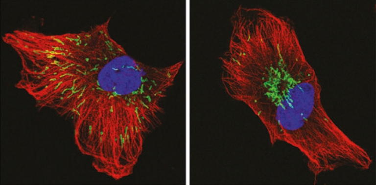 Manipulação das mitocôndrias pode matar células do câncer