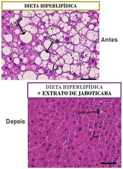 Jabuticaba evita ganho de peso e combate pr-diabetes