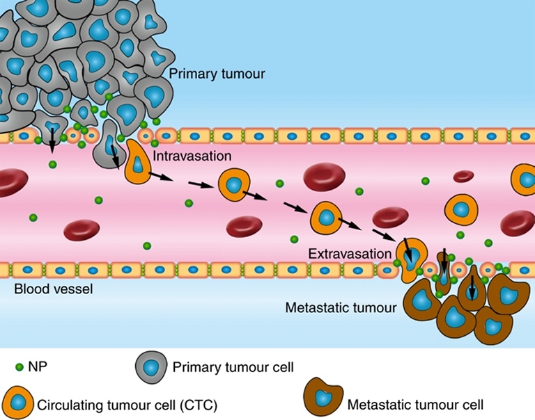 Nanopartículas podem induzir metástase do câncer