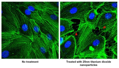 Nanopartículas podem induzir metástase do câncer