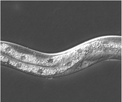 Alimentação com baixas calorias melhora funcionamento das células