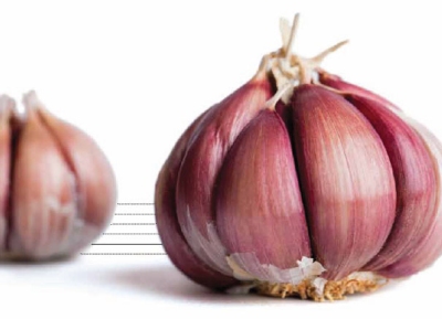 Comer alho e cebola reduz risco de c�ncer colorretal em 80%