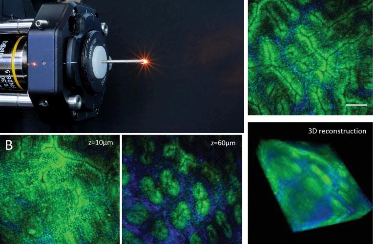 Microscópio miniaturizado será usado dentro do corpo 010110190508-endomicroscopio