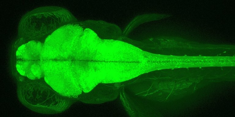Os cabelos mais importantes na sua cabeça podem estar do lado de dentro