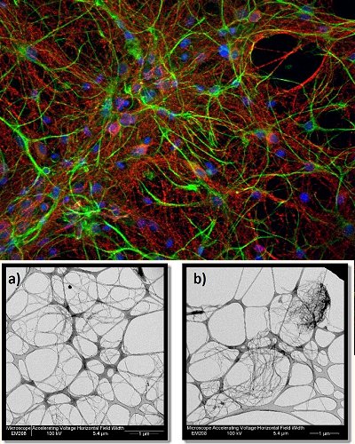 Nanotubos de carbono so ideais para crescimento de neurnios