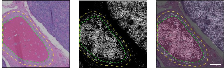 Nova tecnologia de imagem pode revolucionar cirurgia de cncer