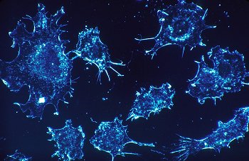 Substância ativada mata tumor e pode imunizar contra cânceres futuros