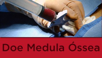 Como é a doação de medula óssea?