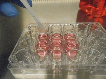 Como é a doação de medula óssea?
