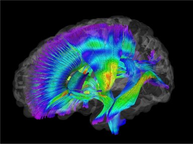 Cientistas questionam confiabilidade de teste para diagnosticar autismo