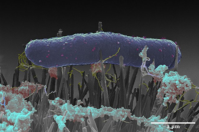Asas de inseto ensinam cientistas a construir materiais antimicrobianos
