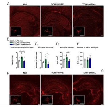 Descoberta protena cerebral que pode retardar doena de Alzheimer