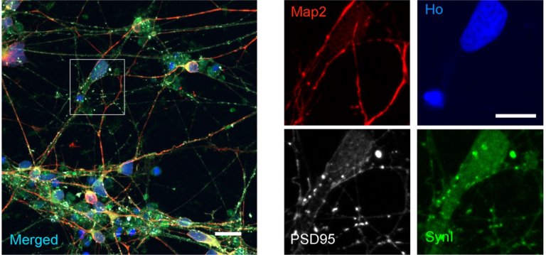 Cientistas criam neur�nios que podem ser integrados ao c�rebro