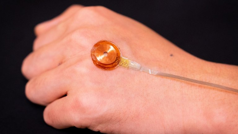 Sensor simples detecta doenças da pele abaixo da superfície