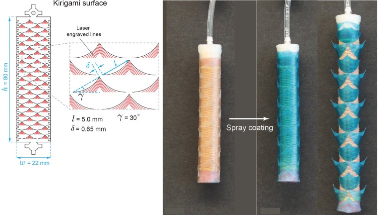 Stents inspirados em kirigami levam medicamentos aos intestinos