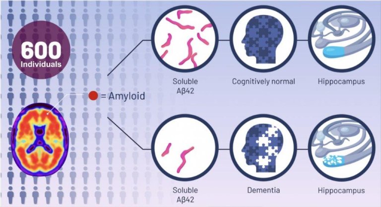 Nova descoberta questiona teoria prevalecente sobre Alzheimer