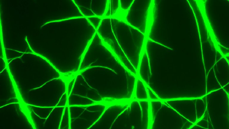 Diferenas entre neurnios de humanos e de cobaias compromete pesquisas cientficas