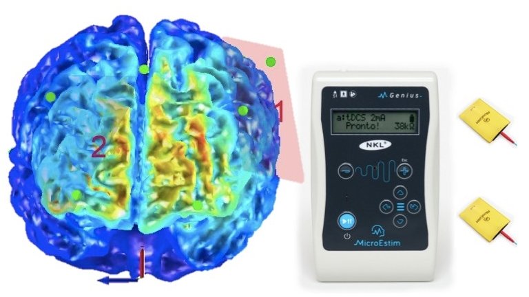 Estimulação elétrica reforça terapia motora de paciente com Parkinson