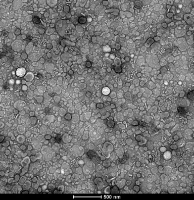 Nanocpsulas de medicamentos so extradas do leite de vaca