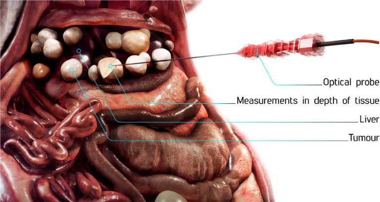 Sistema de bipsia ptica ajuda a diagnosticar cncer de fgado