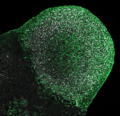 Cérebro-no-chip desmente origem genética de doença rara do desenvolvimento