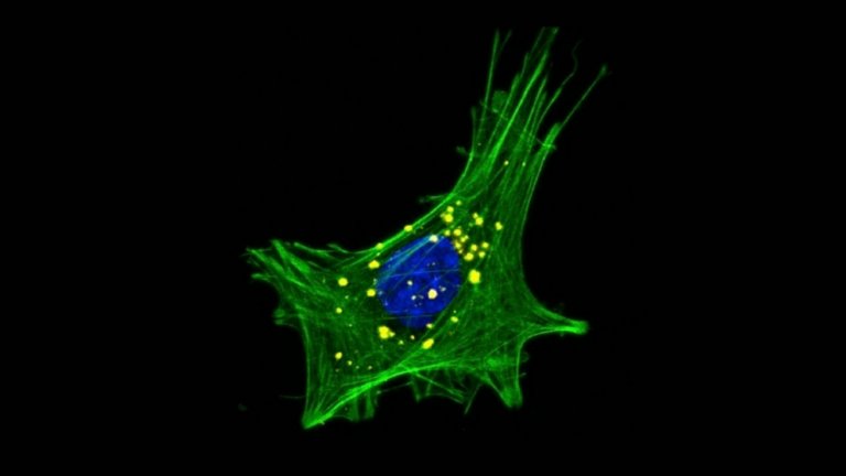 Desequilbrio de bactrias boas no intestino pode causar doena de Parkinson