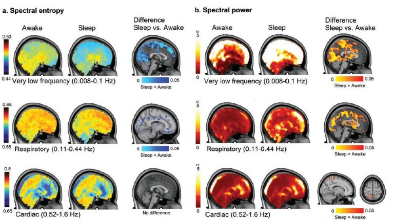 Diferentes ondas durante o sono ajudam a limpar o crebro