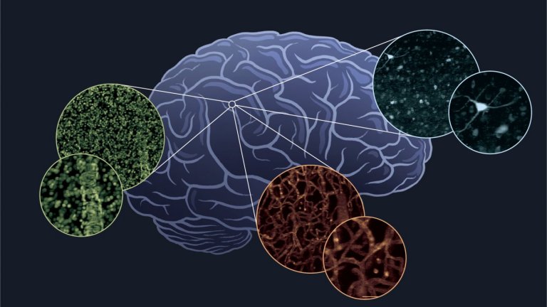 Pesquisadores querem criar um atlas com todas as células do cérebro humano