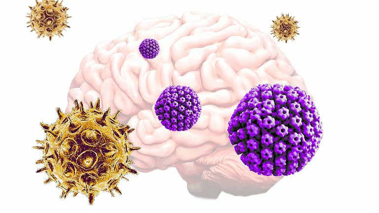 Vrus comuns podem provocar aparecimento da doena de Alzheimer