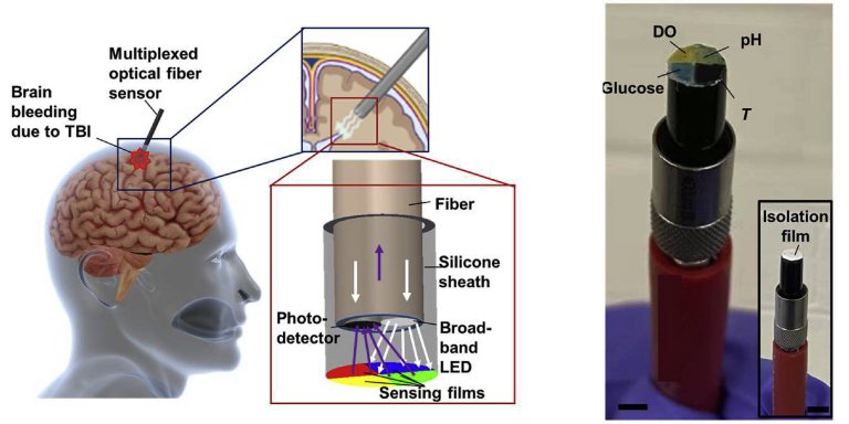 Sensor de fibra óptica monitora quatro indicadores em lesão cerebral