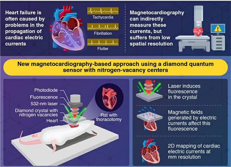 Sensor de diamante mapeia correntes eltricas no corao em alta resoluo