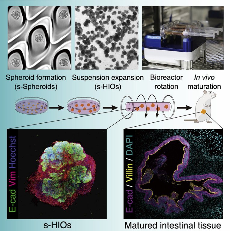 rgos para transplantes? Organoides intestinais robustos so criados em laboratrio