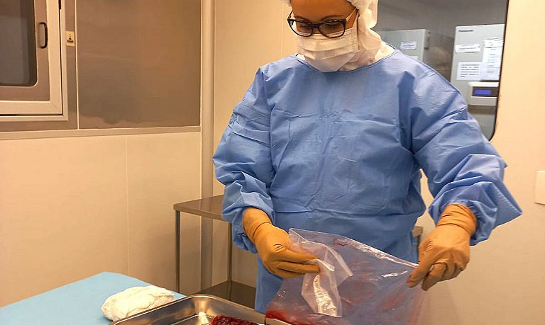 Curativos biolgicos feitos com placenta sero usados em queimaduras